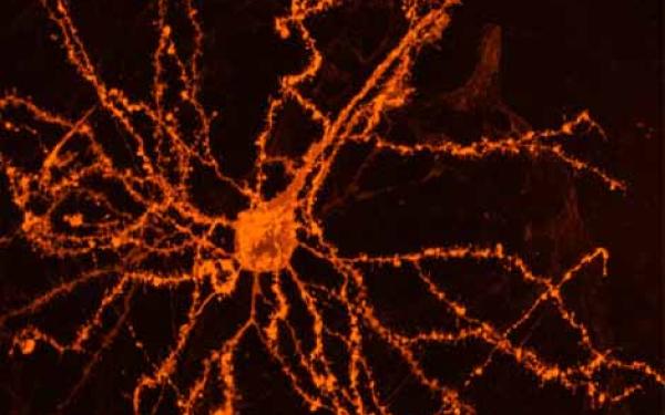 Image of neuron