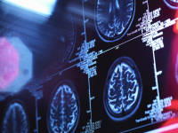 brain scans